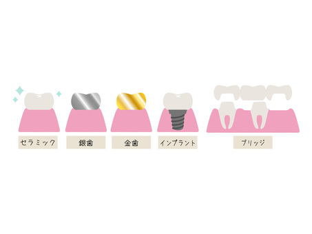 8db53ba1d403d9274422439d78d6986e_t