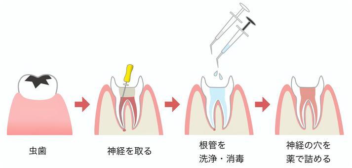 cbf5121309fc779a8e70e79071abe1c9_t